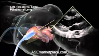 How to do a Basic Transthoracic Echocardiogram Transducer Position and Anatomy [upl. by Norra374]