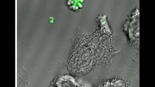 Phagocytosis of MRSA by a human neutrophil [upl. by Oiratnom]