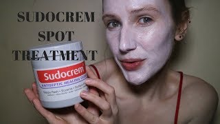 Get rid of spots acne and blemishes FAST Sudocrem Face Mask [upl. by Almire]