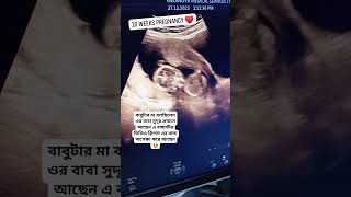 16 Weeks Pregnancy Ultrasonogram  ১৬ সপ্তাহের আলট্রাসোনোগ্রাম কেমন হয় ultrasound pregnancyscan [upl. by Candace]