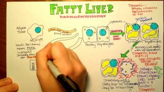 Fatty Liver Pathophysiology [upl. by Nnarefinnej788]