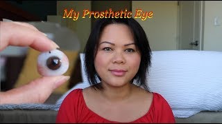 My Prosthetic Eye [upl. by Nanahs]