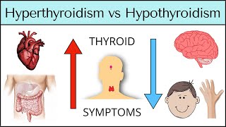 Hyperthyroidism vs Hypothyroidism Symptoms MADE EASY Thyroid Explained [upl. by Olympia602]