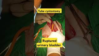 Foley catheter ko urinary bladder mein kaise fix kre  Tube cystostomy vet urineinfection [upl. by Hallvard]