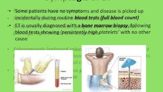 My understanding of Essential Thrombocytosis ET [upl. by Jovia472]