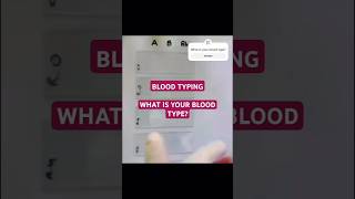 ABO BLOOD TYPINGSLIDE METHOD DO YOU KNOW YOUR BLOOD TYPE COMMENT BELOW 👇 [upl. by Barber]