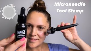 Banish Microneedling Tool stamper 30  Demo  My Reviews [upl. by Ammadis]