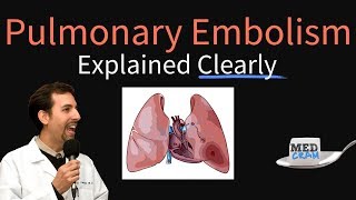 Pulmonary Embolism Explained Clearly  Risk factors Pathophysiology DVT Treatment [upl. by Bronk168]