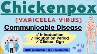 Chickenpox  Varicella zoster virus  Communicable Disease [upl. by Aleik]