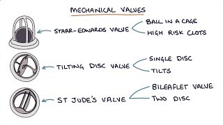 Prosthetic Heart Valves Visual Explanation for Students [upl. by Cherin]