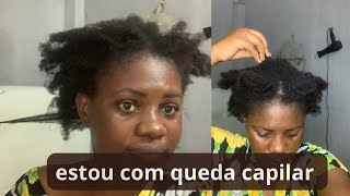 Meu cabelo está caindoatravés da dermatite seborreica [upl. by Oirifrop]