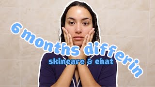 SKIN UPDATE AND LIFE CHAT 🏡🔑  3 months Post Doxycycline and 6 Months Differin Gel Update acne [upl. by Eugnimod819]