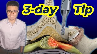 Physical Therapy after Lumbar Laminectomy 03 Day Secrets for Success [upl. by Elisee]