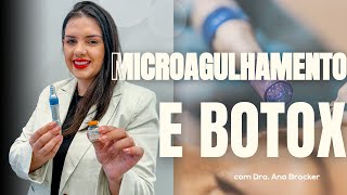 COMO FAZER MICROAGULHAMENTO COM BOTOX  Técnicas associadas [upl. by Haelat]