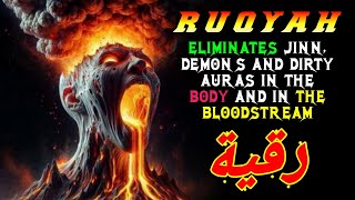 DONT LET THE GENIE NEST IN YOUR BLOOD DESTROY THEM WITH RUQYAH [upl. by Lenhart512]