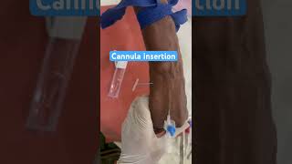 Cannula insertion of old female patient shorts cannula nurses subscribe doctor neet mbbs [upl. by Aramoj]