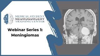 Webinar Series 1 Meningiomas [upl. by Dyob]