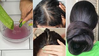 30 Days Double Hair Growth Hacks पतले बालों में 1 बार लगाओ हैरान हो जाओगे बाल होंगे इतने मोटे घने [upl. by Nayek270]