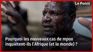 Pourquoi les nouveaux cas de mpox inquiètentils l’Afrique et le monde [upl. by Yntruoc]