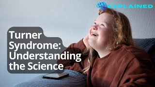 Turner Syndrome Understanding the Science [upl. by Ardnuaek]