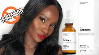 THE ORDINARY MANDELIC ACID  HA  HOW TO USE  REVIEW [upl. by Gellman]