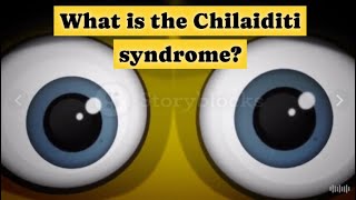 What is the Chilaiditi syndrome [upl. by Supen]