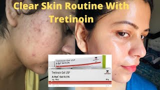 My Updated skin care routine with Tretinoin gel 01  tretinoingel clearskin skincare [upl. by Eilrebma]