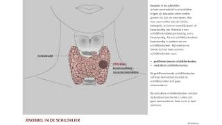 Nodus een knobbel in de schildklier [upl. by Natalie]