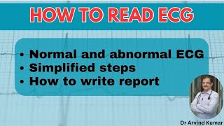 Mastering ECG Reading  Simplified Guide for Interns General Practitioners and Medicine Residents [upl. by Hanover664]