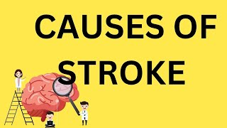 Why Do People Have Strokes [upl. by Necila10]