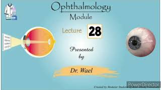 28 Ocular Motility in Health and Disease 3 Paralytic start of Concomitant Squint Dr Wael Ophthalmo [upl. by Jacob]