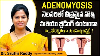 నెలసరిలో తీవ్రమైన నొప్పి  What is Adenomyosis  Adenomyosis Treatment  Treatment Range Hospitals [upl. by Esyla]