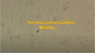 Yersinia Motility Test [upl. by Sothena994]