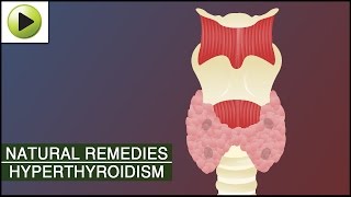 Home Remedies for Hyperthyroidism [upl. by Alaine]