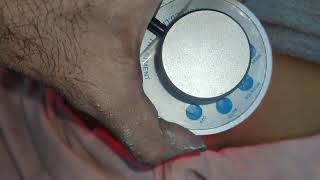 old diamond microdermabrasion machine Wound healing treatment using photon light skin Medico hair [upl. by Wolsky]