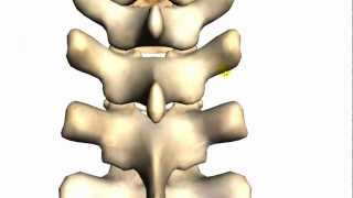 Spine tutorial 2  Features of a vertebra  Anatomy Tutorial [upl. by Sirej]