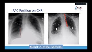 Advanced Invasive Hemodynamic Monitoring [upl. by Llerrac]