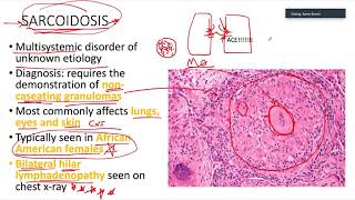 Pulm for USMLE Step 1  Lecture 2 [upl. by Itsrejk969]