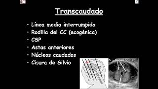 Ecografía del Sistema Nervioso Central fetal FACIL Parte 1 [upl. by Inaej]