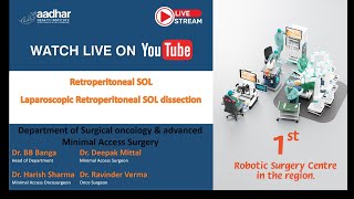 Laparoscopic Retroperitoneal SOL dissection [upl. by Nomi]