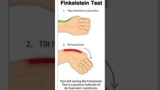 Finkelstein testthephysiodoctorsportsphysiotherapykneepainreliefhumananatomyhamstringinjury [upl. by Anamuj27]