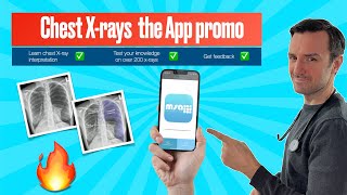 Chest Xray App promo [upl. by Brewster502]