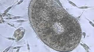 Ciliate Phylum of Protozoa [upl. by Brear]