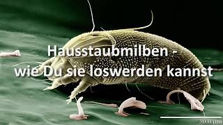 Hausstaubmilben – wie Du sie loswerden kannst [upl. by Obed766]