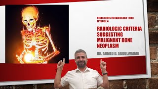 Radiologic Criteria of Malignant Bone Neoplasms Highlights in Radiology HIR episode 4 [upl. by Gyasi341]