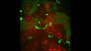 Ctsba CRISPRi mutant microglia [upl. by Ordnael]