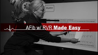 AFib with RVR Made Easy Atrial Fibrillation with Rapid Ventricular Response [upl. by Eesac]