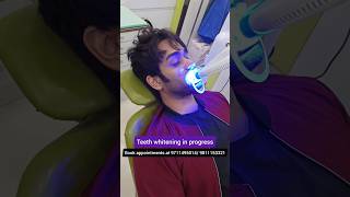 Get Amazing Teeth Whitening QUICK Dr Srishti Bhatia [upl. by Osmo]