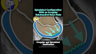 Fig 5B27 Types of Ossification Variants of the Knee [upl. by Anaigroeg]