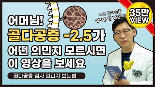 힘내쇼 46화 👉나의 골다공증 성적은 몇 점일까요 골다공증검사 결과 보는법 어렵지 않아요 [upl. by Edina639]